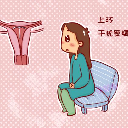 最新型节育环，避孕新里程碑
