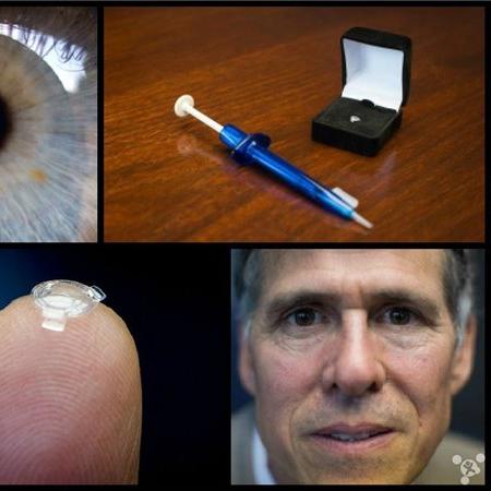 加拿大最新近视矫正技术，引领视力矫正革新